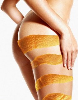 CELULITIS2..jpg