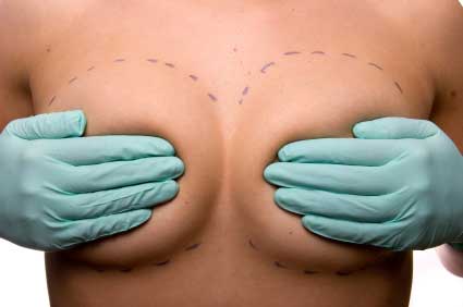 Todo lo que hay que saber sobre implantes mamarios. (Parte I)