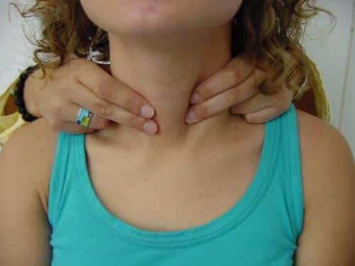 Preguntas frecuentes sobre la tiroides. Parte I
