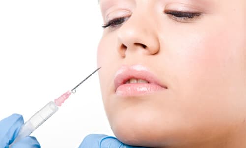 Top 4: beneficios del botox