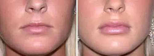 9 preguntas para labios perfectos
