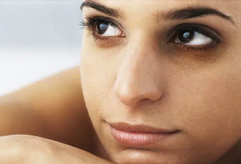 Cómo combatir las ojeras