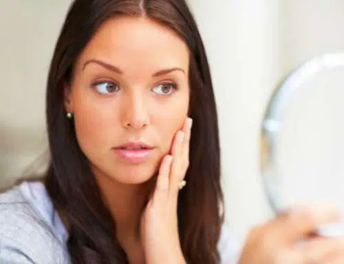 ¿Como puedo eliminar las cicatrices de la varicela?