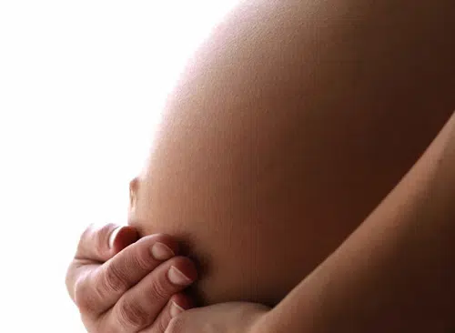 Lo básico que debes conocer acerca de las cesáreas