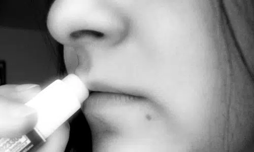 Remedios para labios agrietados